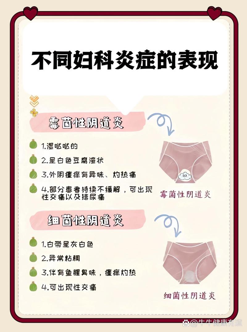 什么是妇科炎症:什么是妇科炎症细胞
