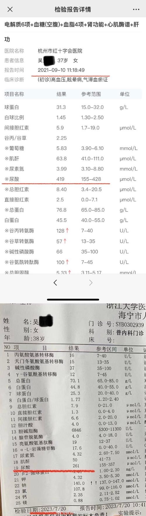 尿酸在化验单上叫什么:尿酸在化验单上叫什么名称